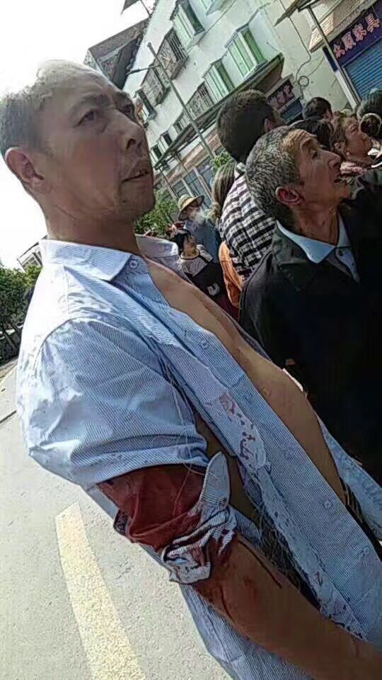 杨小平公开扬言:(混社会的老大)你问一下中和